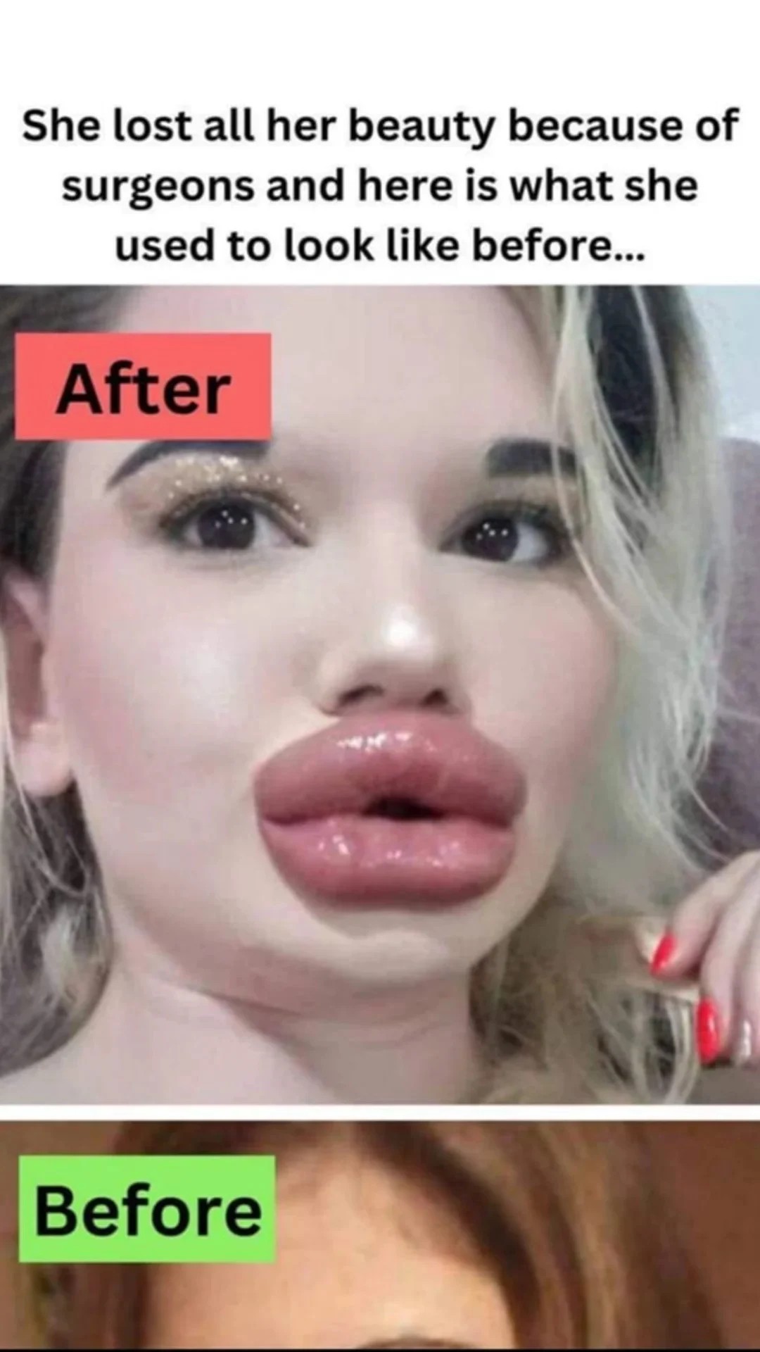 She lost all her beauty because of surgeons and here is what she used to look like before