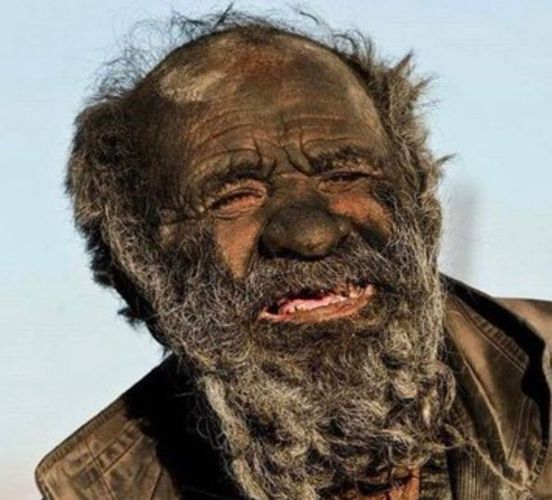 He was titled the ‘world’s dirtiest man’ after having not bathed in 67 years