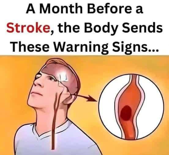 Attention… A Month Before a Stroke, Your Body Sends These Signals